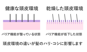 頭皮環境と分け目の関係図